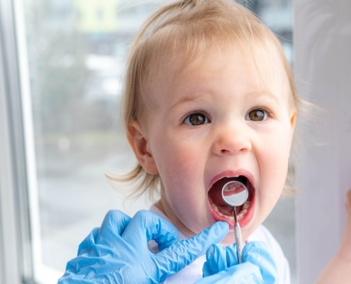 closeup-open-mouth-child-mirror-dentists-hands-blue-gloves-checkup-examine-treating-teeth-child-health-care-children-dental-hygiene